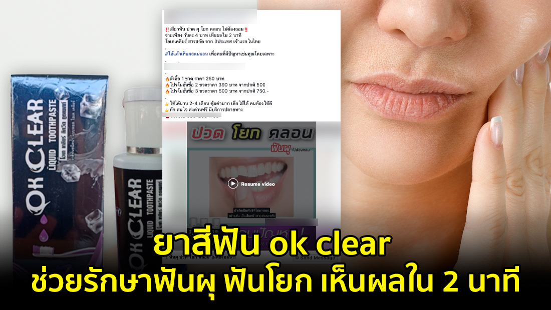 ข่าวปลอม อย่าแชร์! ยาสีฟัน ok clear ช่วยรักษาฟันผุ ฟันโยก เห็นผลใน 2 นาที